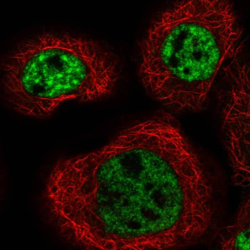 Immunocytochemistry/ Immunofluorescence MFSD11 Antibody - BSA Free