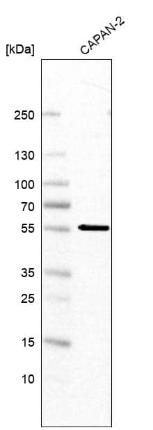 Western Blot MFSD11 Antibody - BSA Free