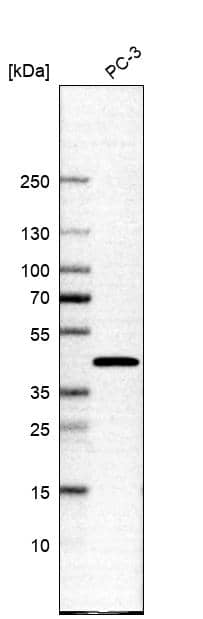 Analysis in human cell line PC-3.