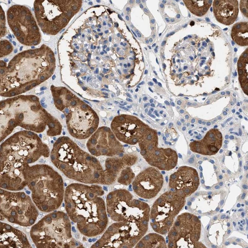 Staining of human kidney shows  strong cytoplasmic positivity in cells in proximal tubules.