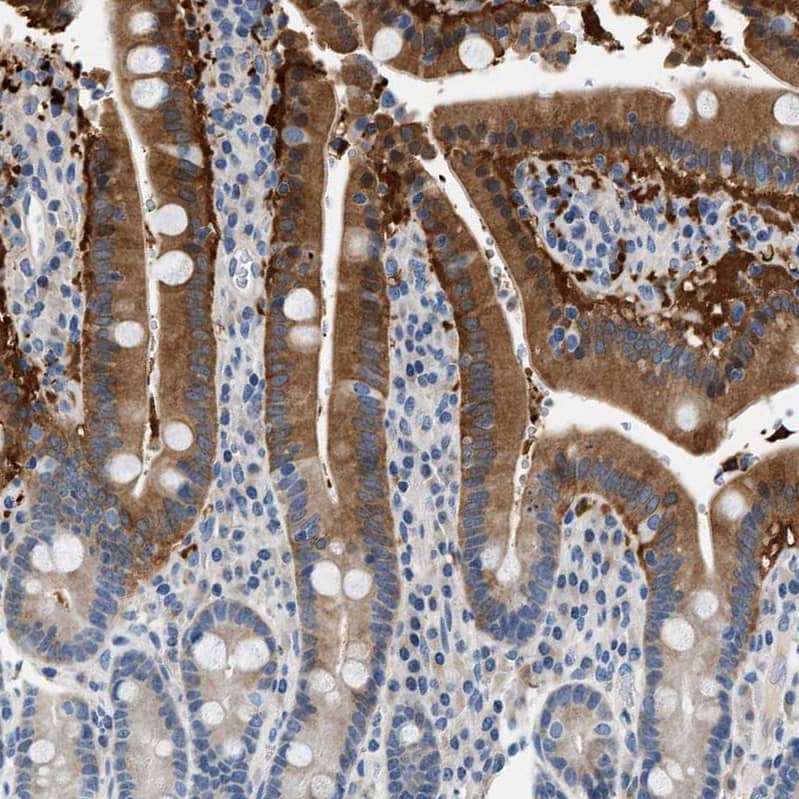 Staining of human duodenum shows moderate to strong cytoplasmic positivity in glandular cells.