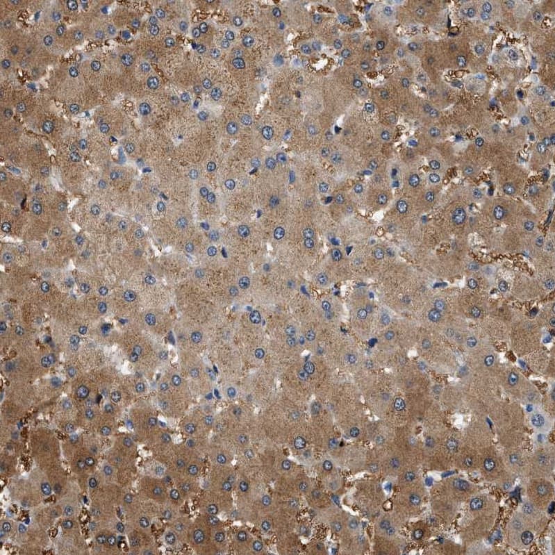 Staining of human liver shows moderate cytoplasmic positivity in hepatocytes.
