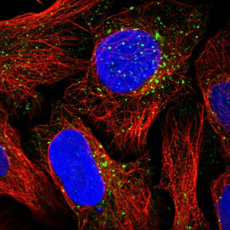Immunocytochemistry/ Immunofluorescence NSUN7 Antibody - BSA Free