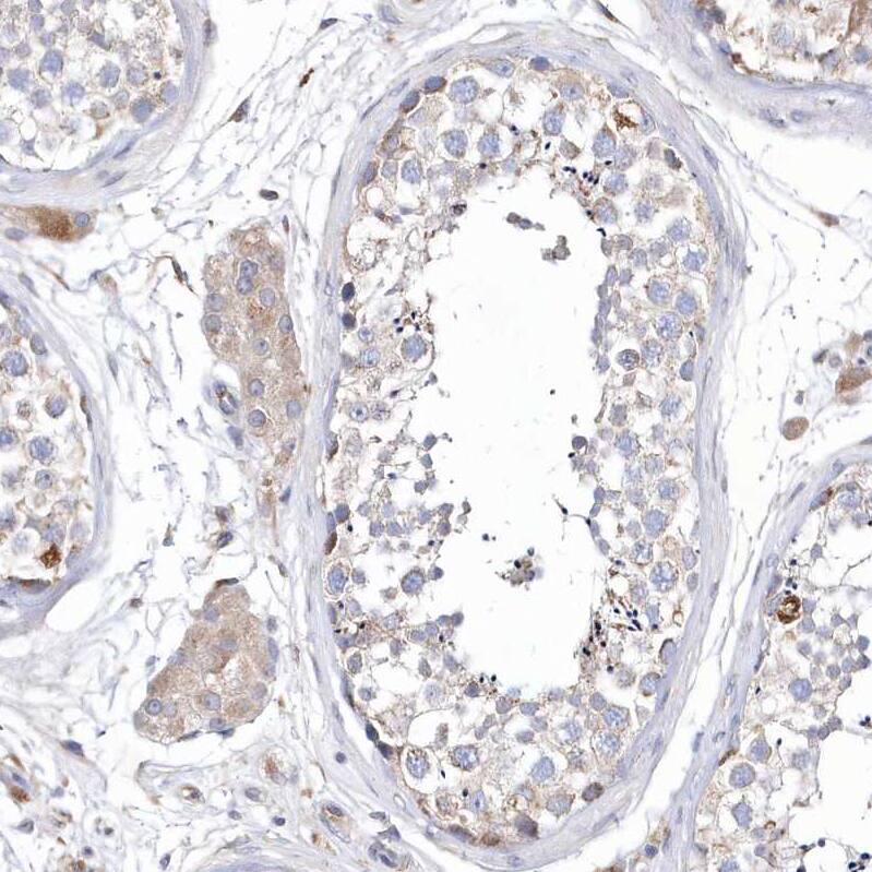 Immunohistochemistry METTL8 Antibody - BSA Free