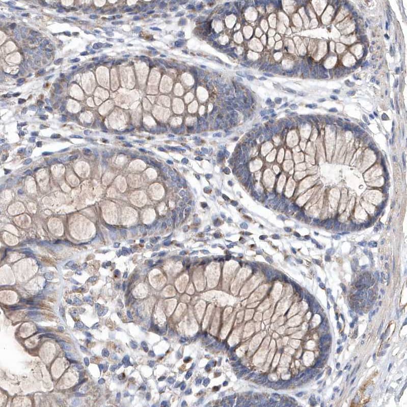 Immunohistochemistry METTL8 Antibody - BSA Free