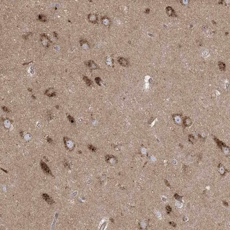 Staining of human hippocampus shows strong cytoplasmic positivity in neuronal cells.