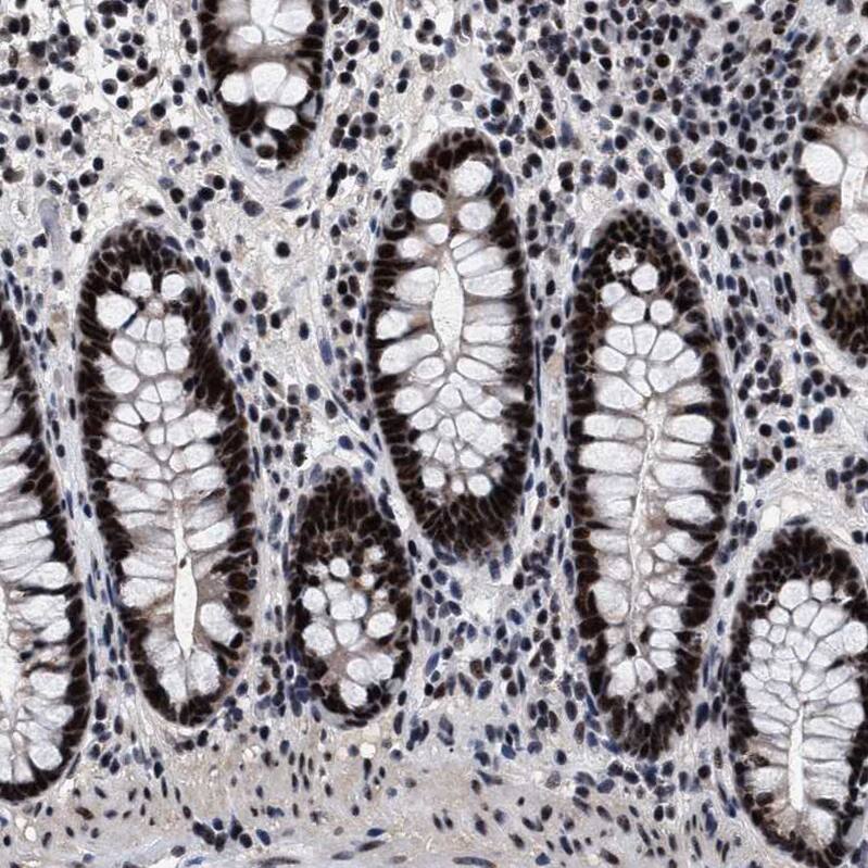Staining of human colon shows strong nuclear positivity in glandular cells.