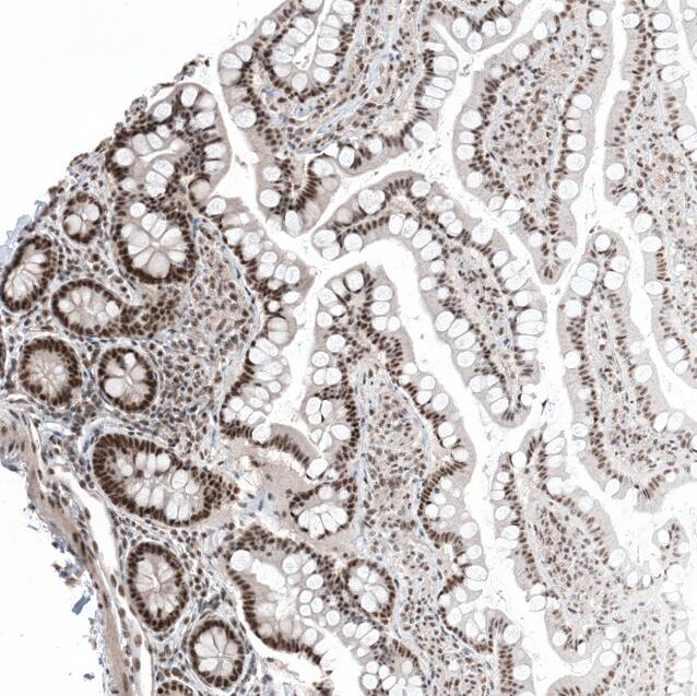 Staining of human small intestine shows strong nuclear positivity in glandular cells.
