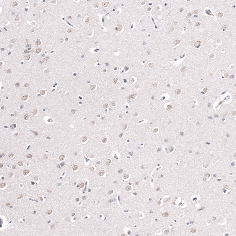 Staining of human cerebral cortex shows moderate nuclear positivity in neuronal cells.
