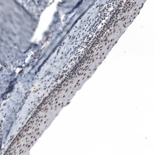 Staining of human cervix shows strong nuclear positivity in squamous epithelial cells.