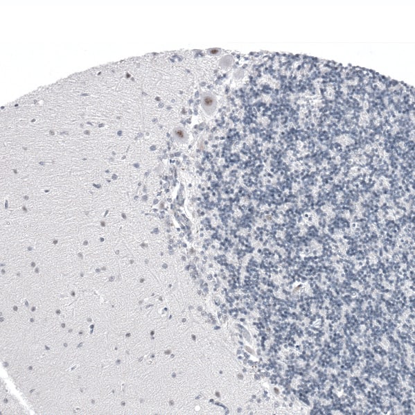 Staining of human cerebellum shows moderate nuclear positivity in Purkinje cells.