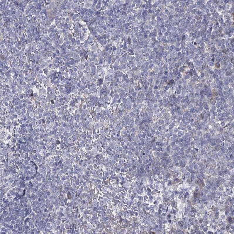 Staining of human tonsil shows no positivity in non-germinal center cells as expected.