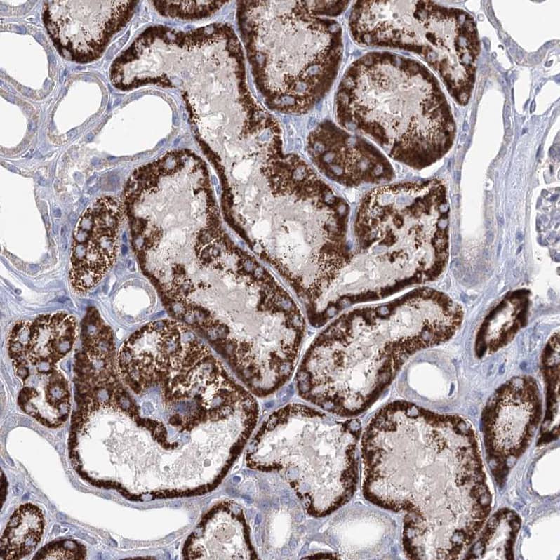 Staining of human kidney shows strong granular cytoplasmic positivity in cells in tubules.