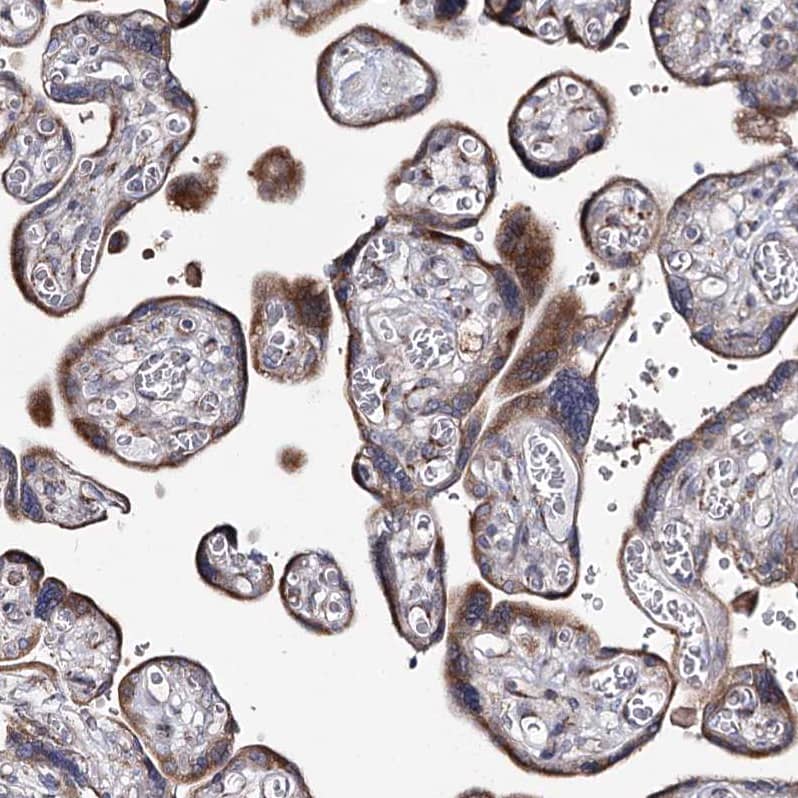 Staining of human placenta shows moderate granular cytoplasmic positivity in trophoblastic cells.