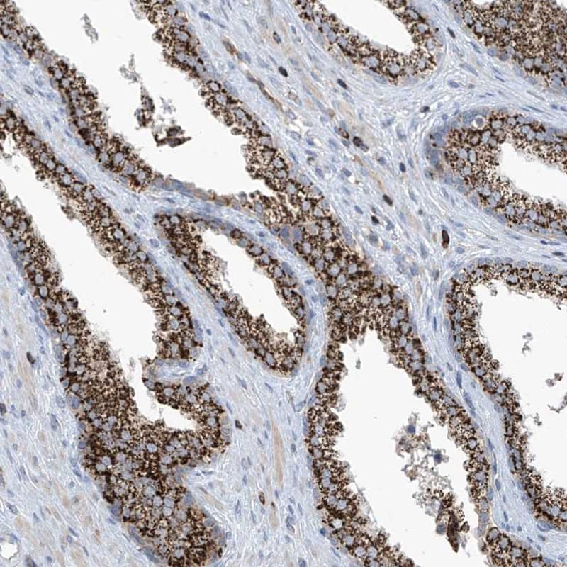Immunohistochemistry-Paraffin IBA57 Antibody - BSA Free