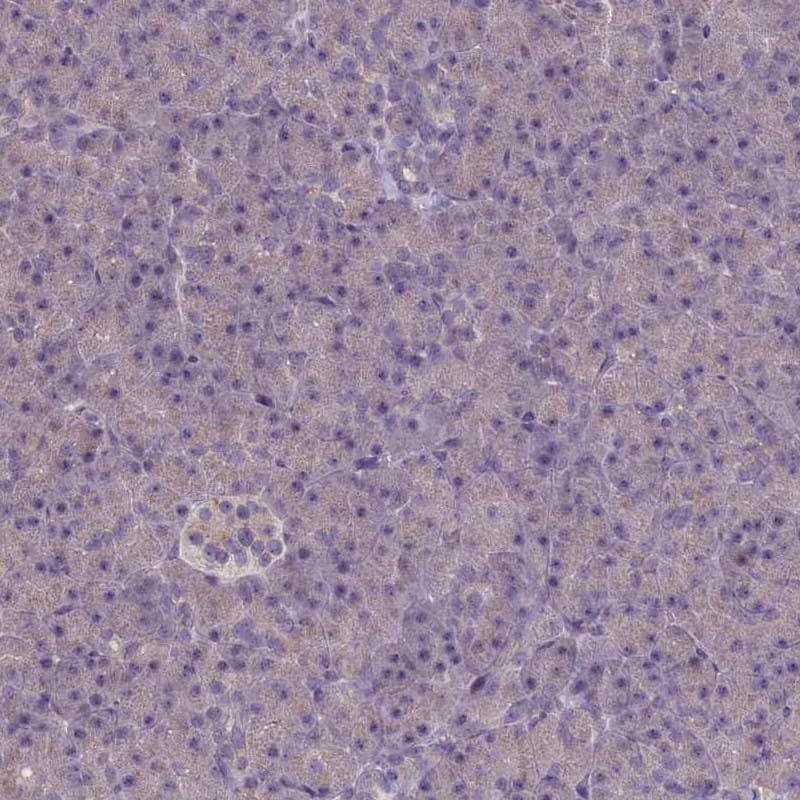 Staining of human pancreas shows low expression as expected.