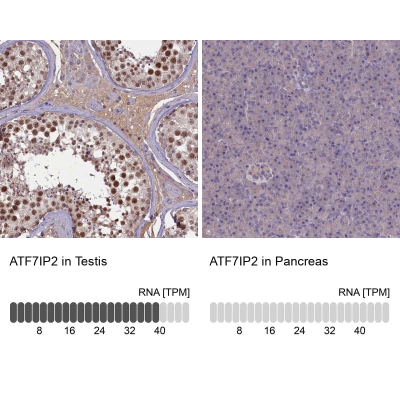 <b>Orthogonal Strategies Validation. </b>Analysis in human testis and pancreas tissues using Anti-ATF7IP2 antibody. Corresponding ATF7IP2 RNA-seq data are presented for the same tissues.