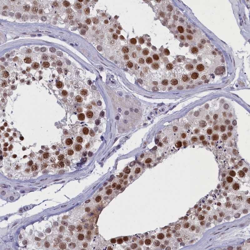 Staining of human testis shows strong nuclear positivity in cells in seminiferus tubules.
