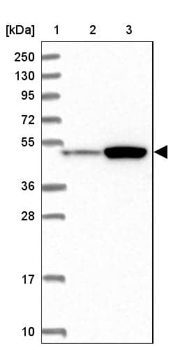 Western Blot ATF7IP2 Antibody - BSA Free