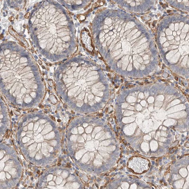 Immunohistochemistry JMJD4 Antibody - BSA Free