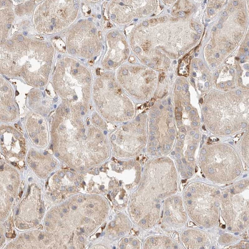 Immunohistochemistry JMJD4 Antibody - BSA Free