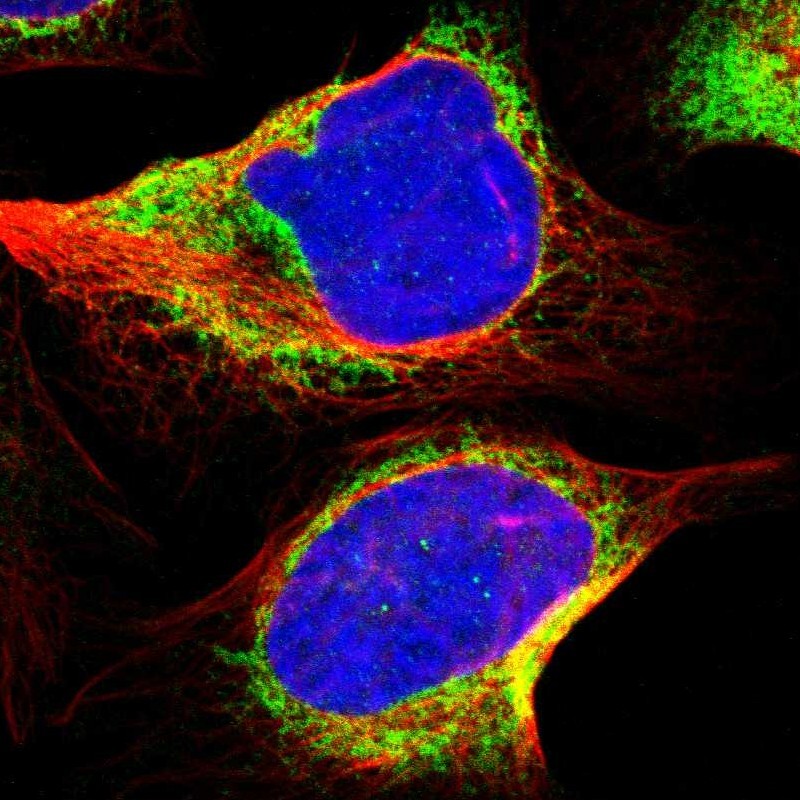 Staining of human cell line U-2 OS shows localization to endoplasmic reticulum.