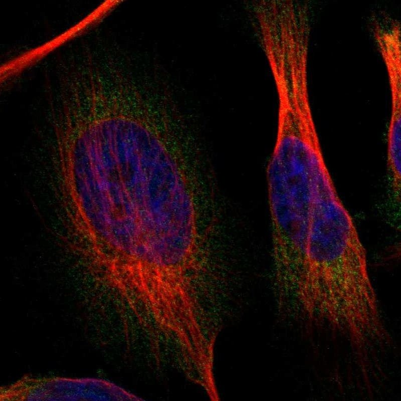 Staining of human cell line U-251 MG shows localization to cytosol.