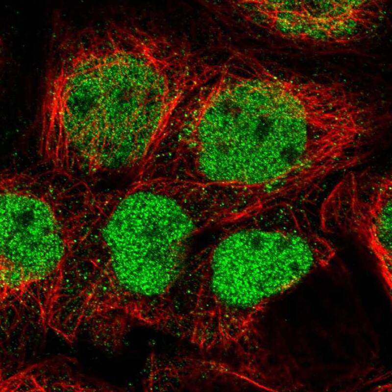 Immunocytochemistry/ Immunofluorescence GPATCH2L Antibody - BSA Free