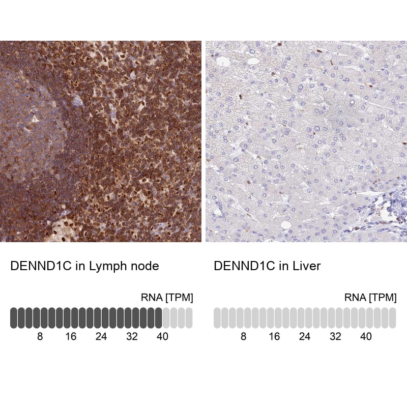 Immunohistochemistry DENND1C Antibody - BSA Free