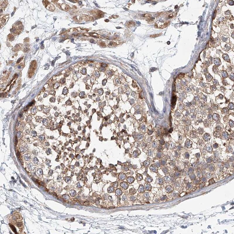 Staining of human testis shows moderate cytoplasmic positivity in seminiferous duct cells.