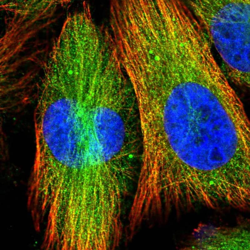 Staining of human cell line U-251 MG shows localization to cytosol & microtubules.