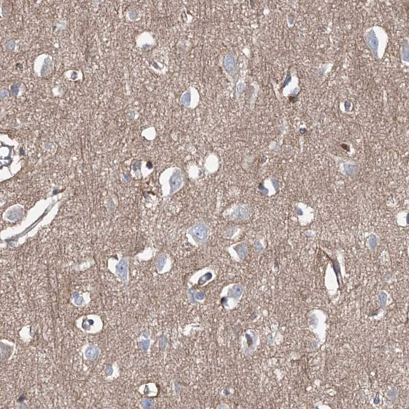 Staining of human cerebral cortex shows moderate cytoplasmic positivity in neuropil.