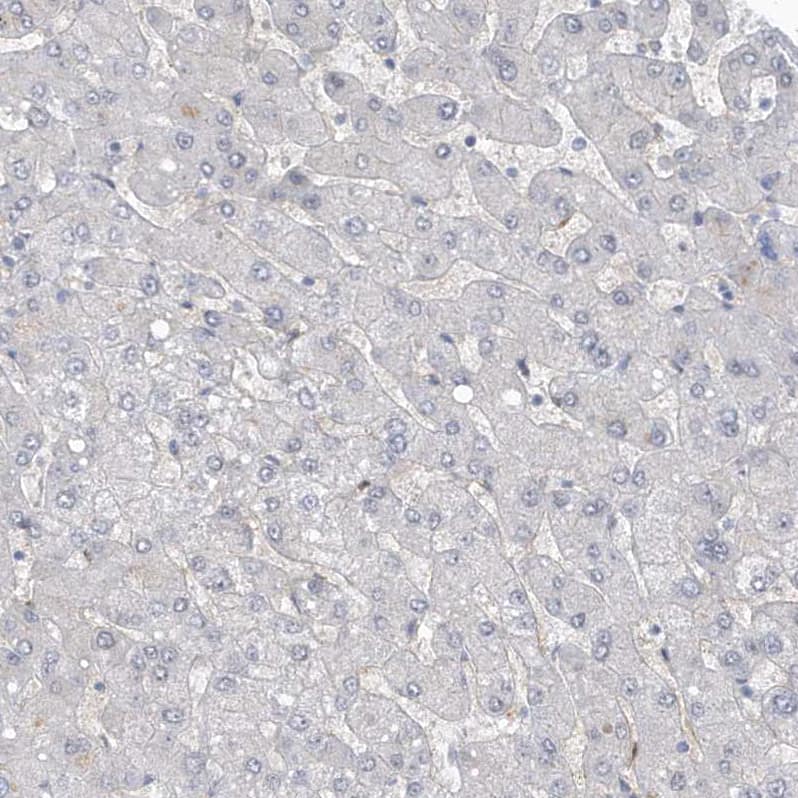 Staining of human liver shows no positivity in hepatocytes as expected.