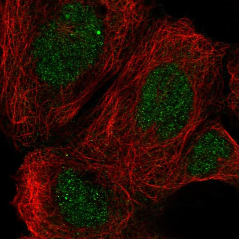 Staining of human cell line A-431 shows localization to nucleus & cytosol.
