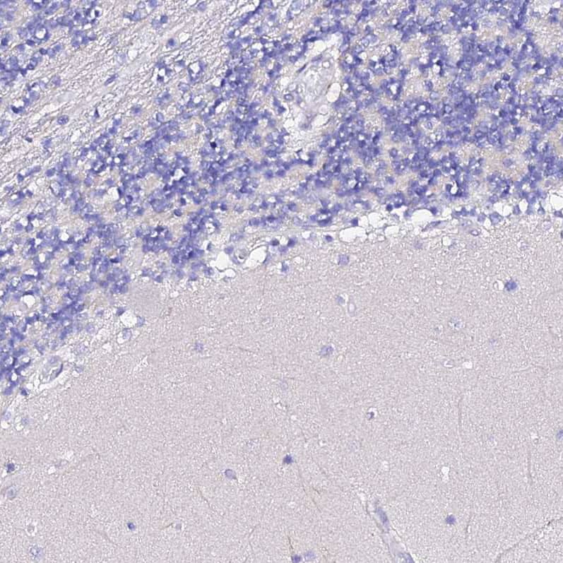 Staining of human cerebellum shows no positivity in Purkinje cells as expected.