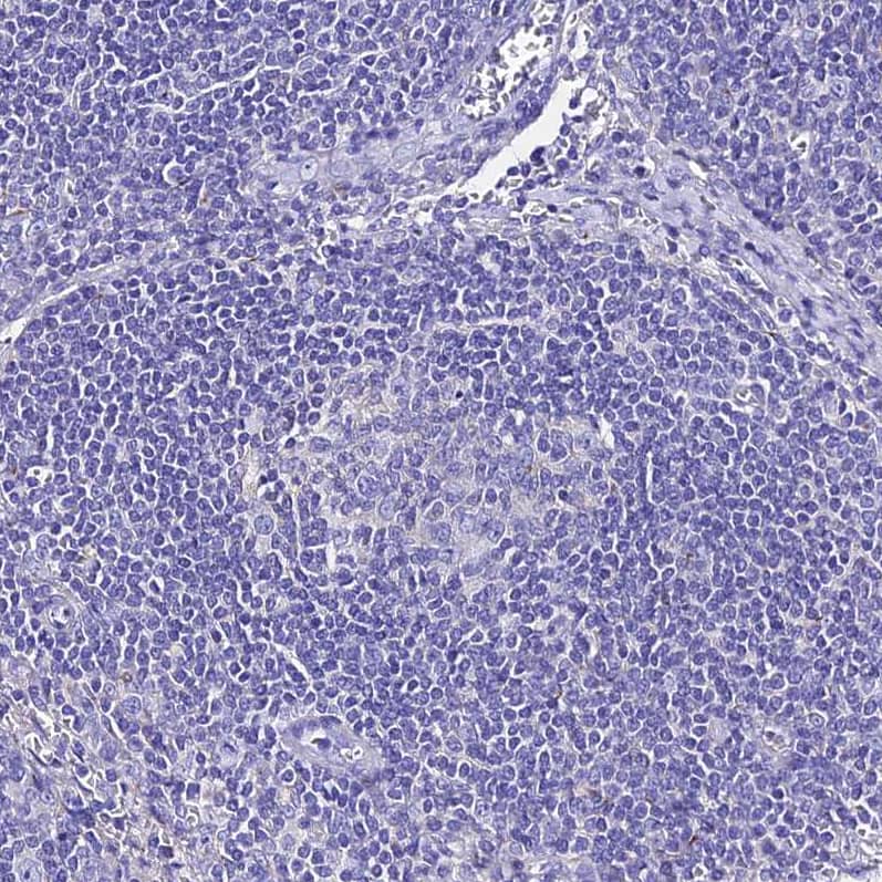 Staining of human lymph node shows no positivity in non-germinal center cells as expected.