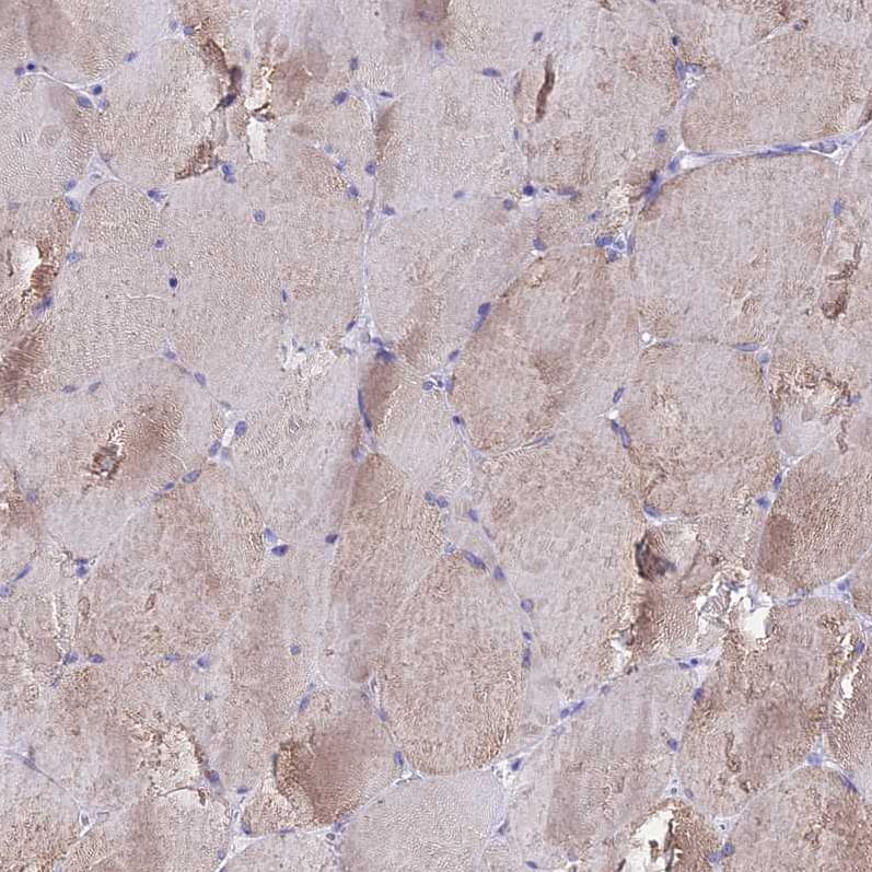 Staining of human skeletal muscle shows moderate cytoplasmic positivity in myocytes.