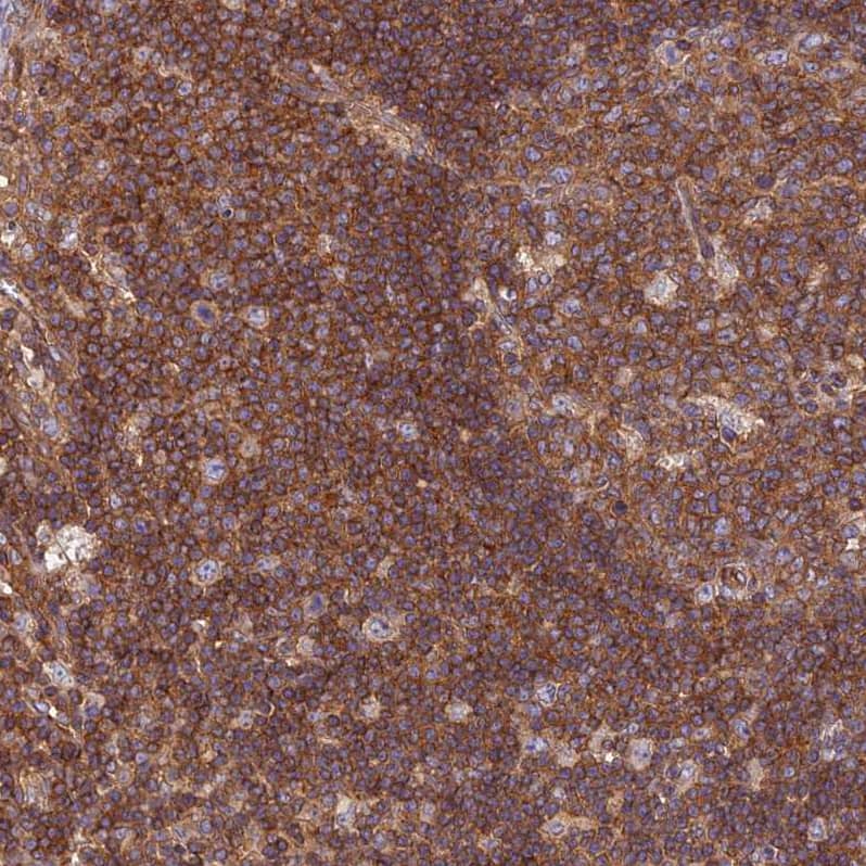 Staining of human lymphoid node shows strong cytoplasmic and membranous positivity in germinal and non germinal center cells.