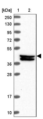 Lane 1: Marker [kDa] 250, 130, 95, 72, 55, 36, 28, 17, 10Lane 2: Human cell line RT-4