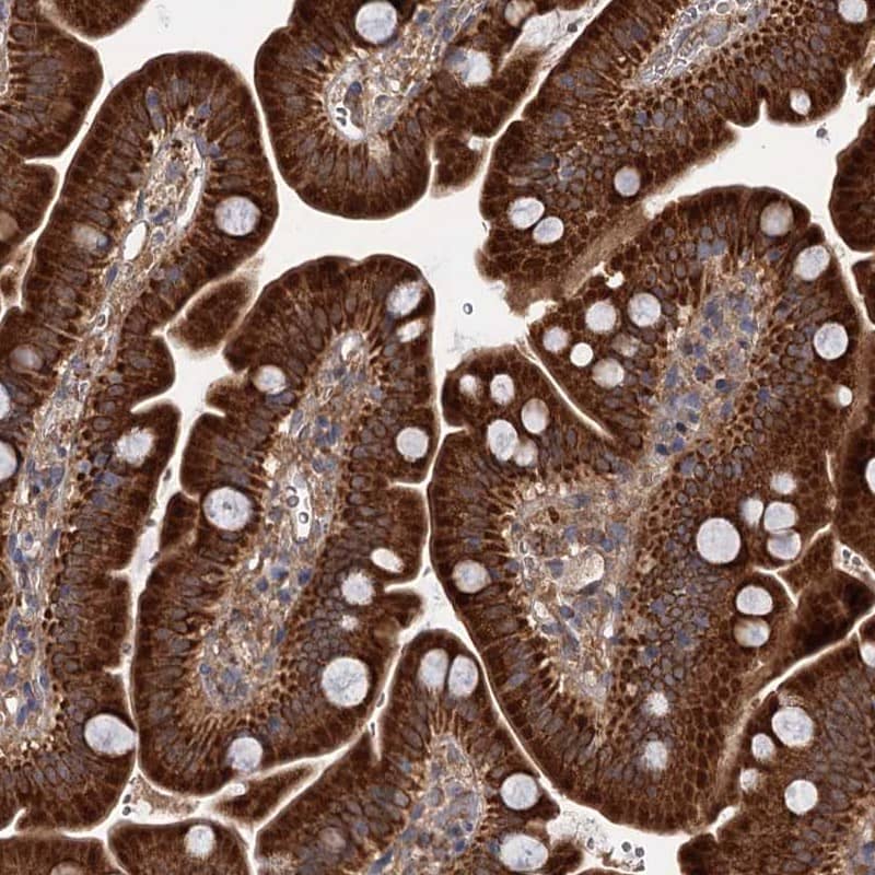 Immunohistochemistry-Paraffin DYNC2H1 Antibody - BSA Free