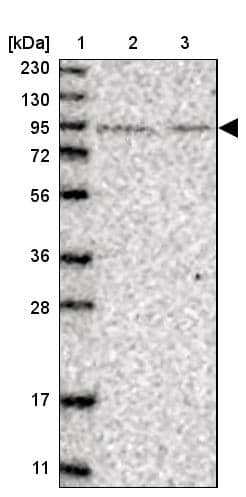 Lane 1: Marker [kDa] 230, 130, 95, 72, 56, 36, 28, 17, 11Lane 2: Human cell line RT-4Lane 3: Human cell line U-251MG sp