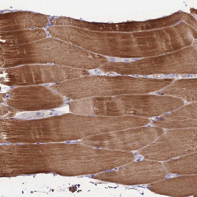 Staining of human skeletal muscle shows strong cytoplasmic positivity in myocytes.