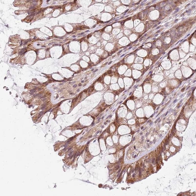 Immunohistochemistry-Paraffin CHURC1 Antibody - BSA Free