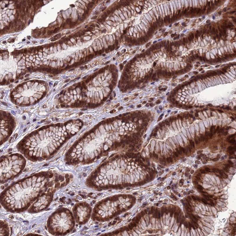 Staining of human stomach, upper shows strong nuclear and cytoplasmic positivity in glandular cells.