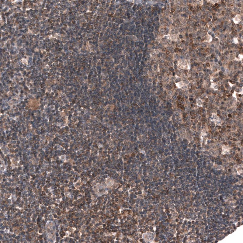 Staining of human lymph node shows moderate cytoplasmic positivity in non-germinal- and germinal center cells.