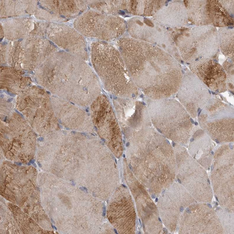 Staining of human skeletal muscle shows moderate cytoplasmic positivity in myocytes.