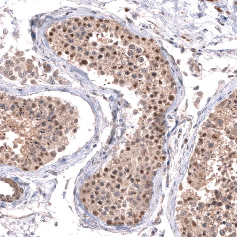 Staining of human testis shows moderate nuclear positivity in a subset of cells in seminiferous ducts.