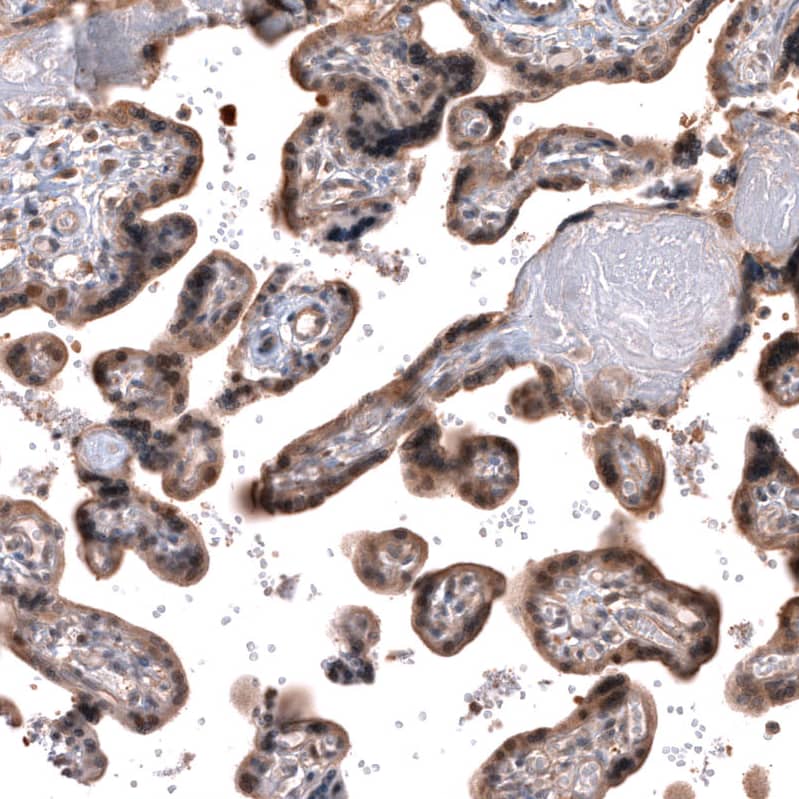 Staining of human placenta shows moderate cytoplasmic and nuclear positivity in trophoblastic cells.