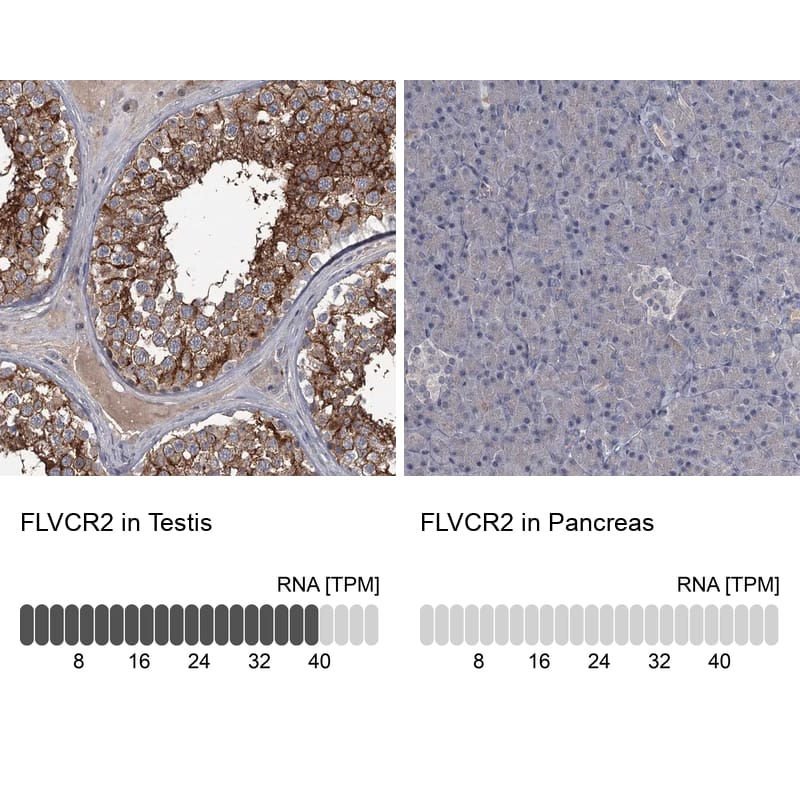 Immunohistochemistry-Paraffin FLVCR2 Antibody - BSA Free
