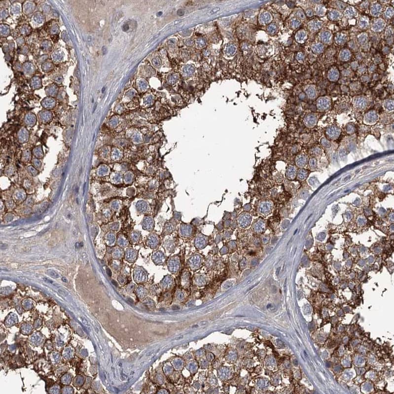 Immunohistochemistry-Paraffin FLVCR2 Antibody - BSA Free